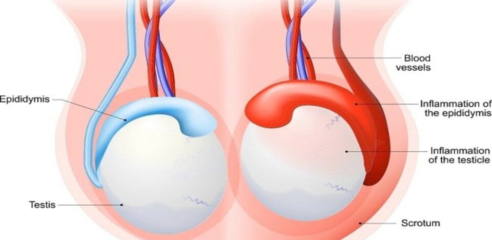 Menjaga Kesehatan Testis