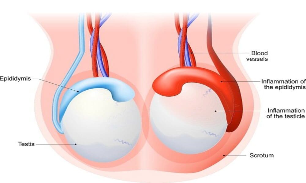 Menjaga Kesehatan Testis